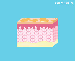 oily skin texture , vector , oily skin icon