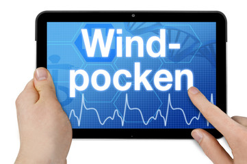 Tablet mit Diagnose und Windpocken, Masern, Mumps, Röteln, Kinderkrankheiten