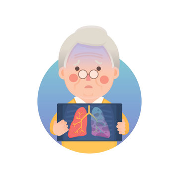 Vector Illustration Of Old Man Holding X-ray Image Showing Lung Cancer Problem, Cartoon Character
