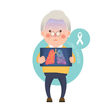 Vector Illustration of Old Man Holding X-ray Image Showing Lung Cancer Problem, Cartoon Character
