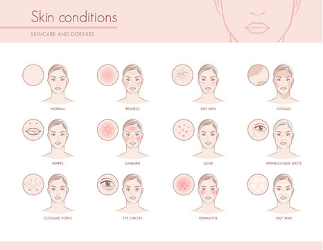 Skin conditions