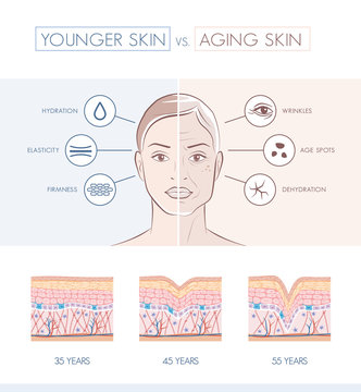Younger and older skin comparison