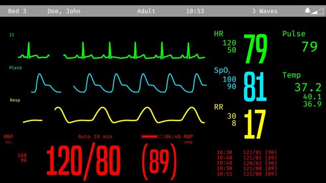 Monitoring of patient's condition, vital signs on ICU monitor in hospital

