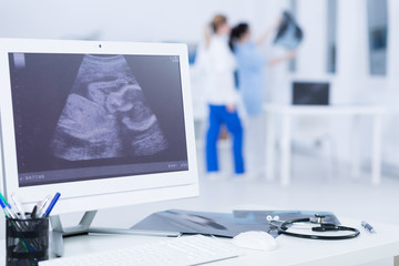 Ultrasound image confirming doctor's good diagnosis