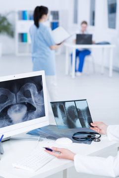 Comparing x-ray results to diagnose a patient
