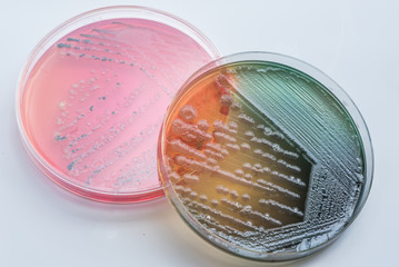 Bacterial colonies culture on  selective agar media XLT Agar (Xy