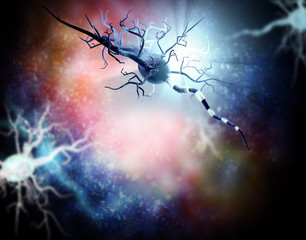     Damaged nerve cells, concept for neurodegenerative and neurological disease, tumors, brain surgery. 