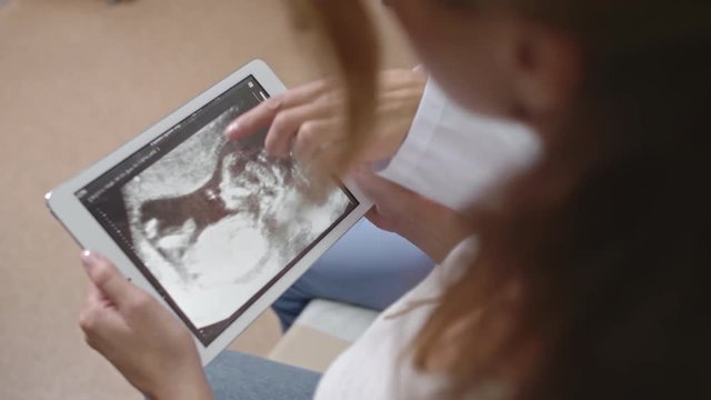 Over the shoulder shot of woman holding tablet with picture of ultrasound scan on it and listening to her doctor explaining it 