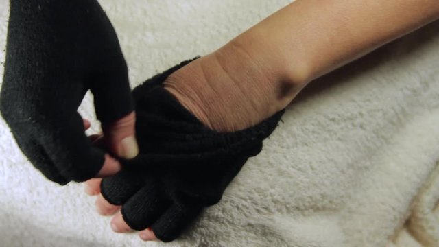 Woman Hands With Gloves, Revealing Severe Allergies To Cold, Red And Itchy Skin
