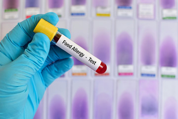 Blood sample for food allergy test
