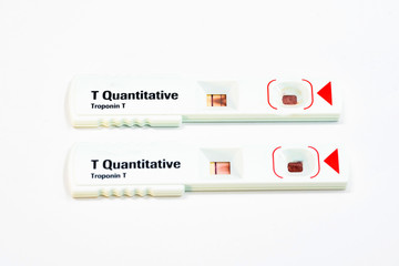 Compare Troponin T test : Positive and Negative,