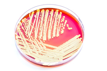 Micrococcus luteus.