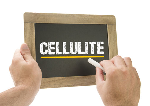 Cellulite - Hand schreibt auf Kreidetafel