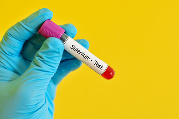 Blood sample for selenium test
