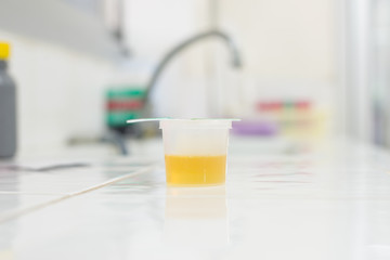 Urine specimen for Urine examination in laboratory.