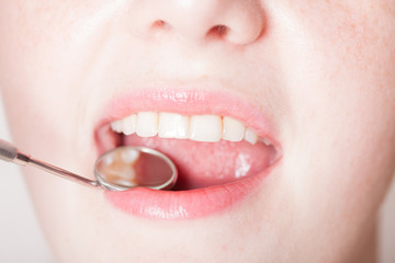 Fototapeta premium Check the teeth