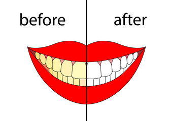 Smiling before after. Vector