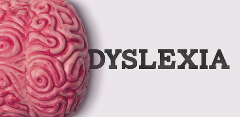 Brain on a plain background with the word Dyslexia - obrazy, fototapety, plakaty