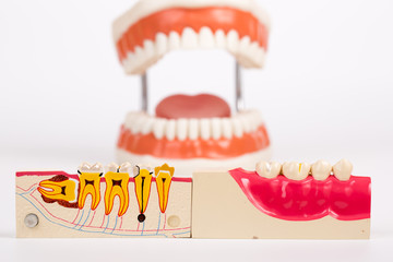 Dental Teeth Model and dental tool on whie background