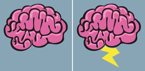 Brainstorming - Cerveau