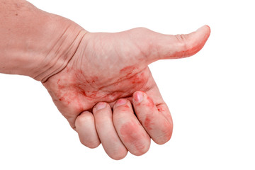 Like a hand stained in blood. on  white background