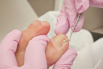 Doctor Podiatry removes calluses, corns and treats ingrown nail. Hardware manicure. Concept body care.
- 123968806