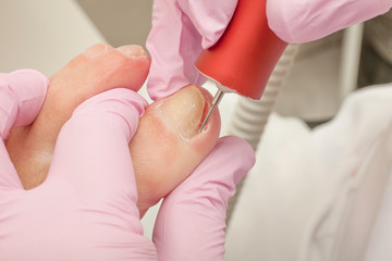 Doctor Podiatry removes calluses, corns and treats ingrown nail. Hardware manicure. Concept body...