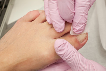 Doctor Podiatry removes calluses, corns and treats ingrown nail. Hardware manicure. Concept body care.
- 123969256