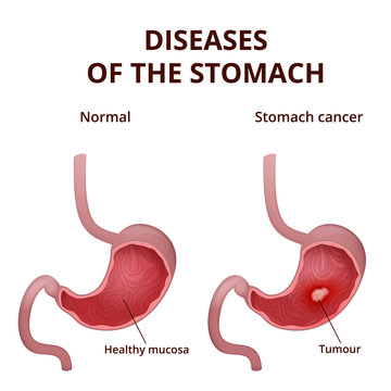 Anatomy of the human stomach