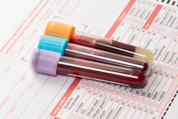 Blut Labortest,Blutuntersuchung, Blutproben auf einem Laborformular