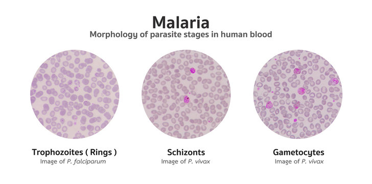 Malarial parasite:- Part 3 - Plasmodium vivax, Benign Tertian Malaria -  Labpedia.net