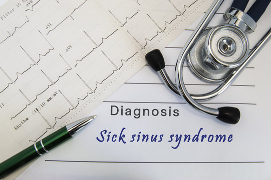 Diagnosis of Sick sinus syndrome. Stethoscope, green pen and electrocardiogram lie on medical form with diagnosis of Sick sinus syndrome on the desk in the office of cardiologist 