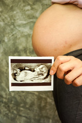 Pregnant Woman Holding Ultrasound Scan Photo