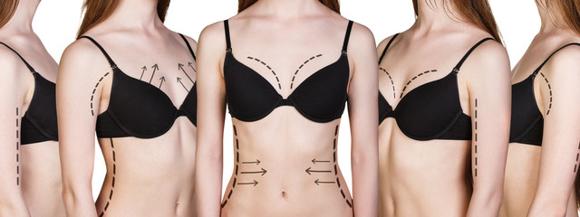 Woman body with correction arrows from all angles