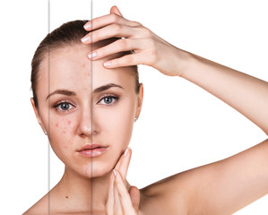 Woman with problem skin