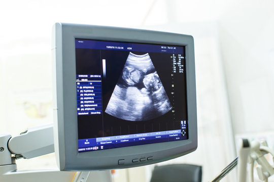 Medical specialists near ultrasound machine in the clinic