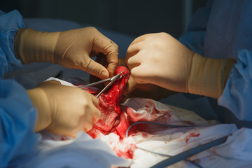 Close up of operation on bodies