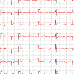 Electrocardiogram red graph with marks on white, seamless pattern