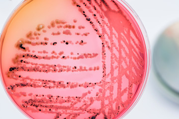 Bacterial colonies culture on  selective agar media XLT Agar (Xy
