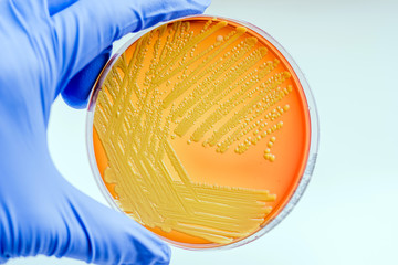 Micrococcus luteus: Gram-positive, to Gram-variable, nonmotile, Coccus, saprotrophic bacterium that...