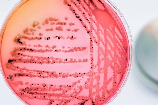 Bacterial colonies culture on  selective agar media XLT Agar (Xy