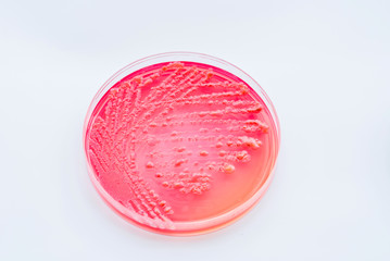 Bacterial colonies culture on  Differential and Selective media