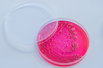 Bacterial colonies culture on  selective agar media XLT Agar (Xy