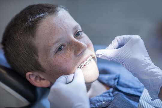 Boy with braces receiving dental floss treatment