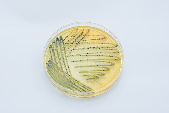 Bacterial colonies culture on  selective agar media XLT Agar (Xy