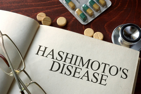 Book with diagnosis Hashimoto disease and pills. Medical concept.