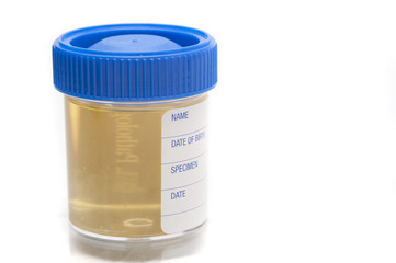 urine sample jar