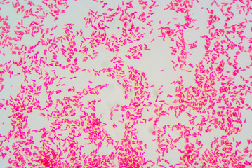 Gram staining, also called Gram's method, is a method of differe