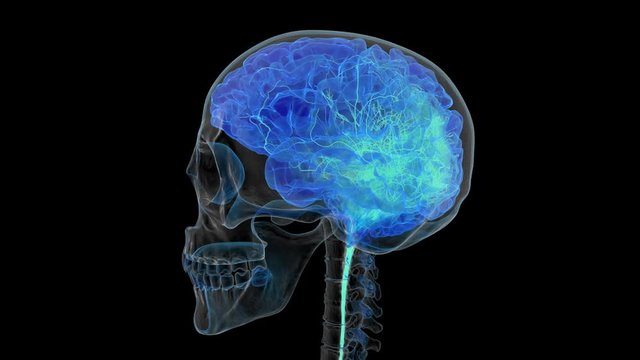 X-ray of human skull with brain being covered with artificial network.