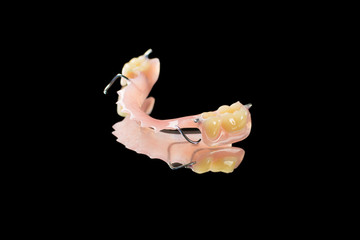 Acrylic partial denture - provisional prosthesis